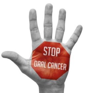 8 semplici step per riconoscere il cancro orale.